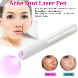 Blue Red Light Therapy Acne Spot Treatment Laser Pen Scar Wrinkle Removal Device Blackhead Blemish Remover Face Skin Care Tool