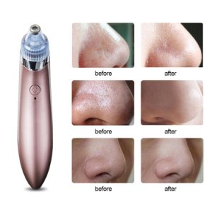 Pore Cleaner Face Cleansing Beauty Instrument Deep Cleansing Dead Skin Blackhead Remover Face Massager Skin Care Tools Practical