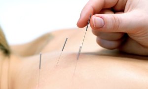 60-Minute Acupuncture Session or 30-Minute Massage with 30-Minute Acupuncture Session at AcuBreathing